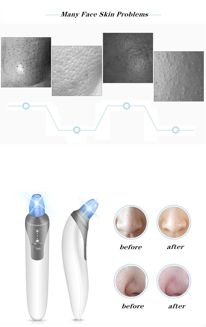 facial facial beauty instrument products personal care-2